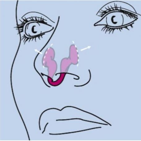 Airmax Classic Dilatateur Nasal 